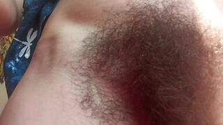 OMG hairy parasite, farts and queefs